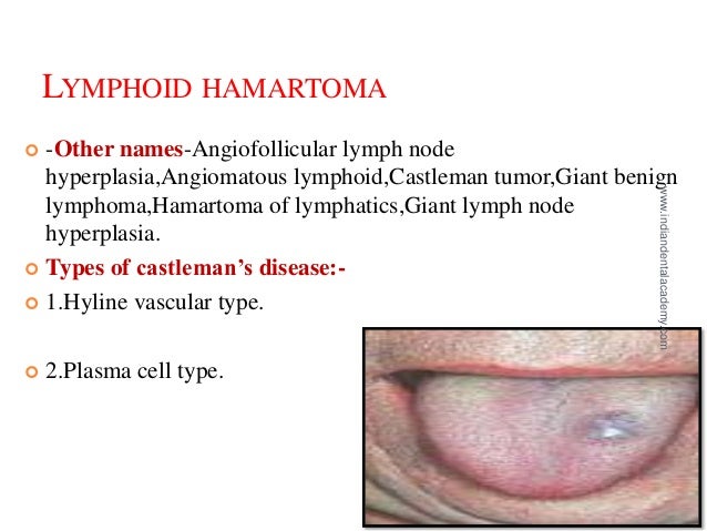 DEVELOPMENTAL DISTURBANCES OF ORAL LYMPHOID TISSUE / dental crown & b…