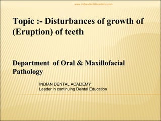 Topic :-Topic :- Disturbances of growth of
(Eruption) of teeth
Department of Oral & MaxillofacialDepartment of Oral & Maxillofacial
PathologyPathology
INDIAN DENTAL ACADEMY
Leader in continuing Dental Education
www.indiandentalacademy.com
 