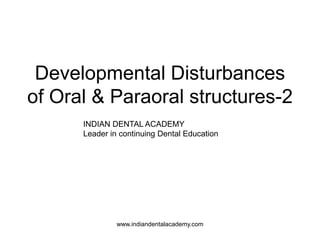 Developmental Disturbances
of Oral & Paraoral structures-2
INDIAN DENTAL ACADEMY
Leader in continuing Dental Education
www.indiandentalacademy.com
 
