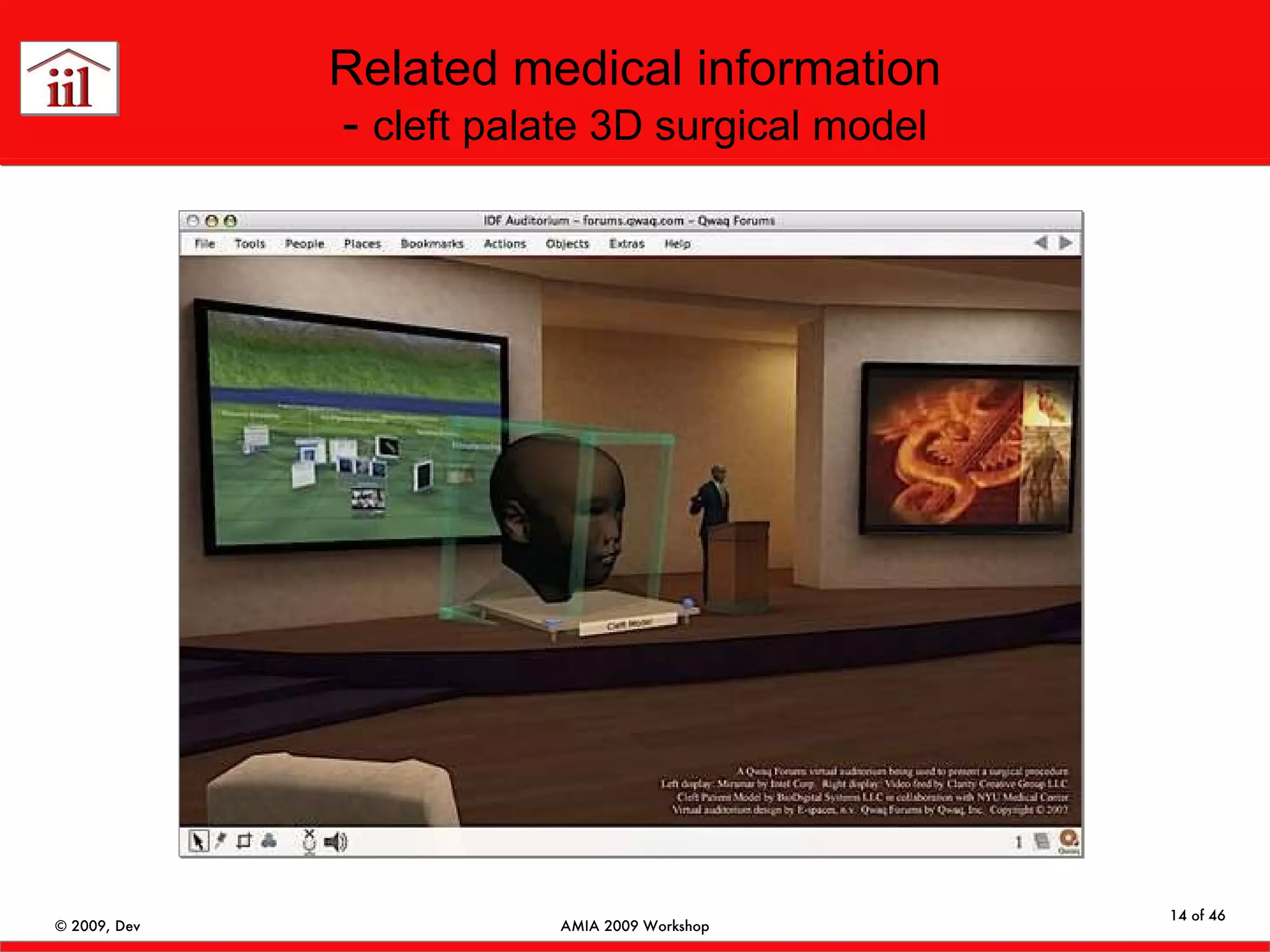 Related medical information -  cleft palate 3D surgical model 