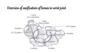 AGE ESTIMATION WITH X RAY WRIST JOINT | PPTX