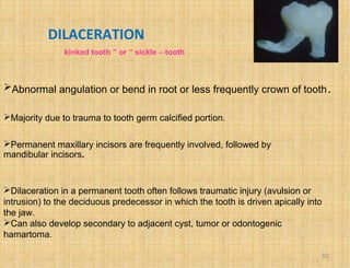 Developmental disturbances ofteeth sem | PPT