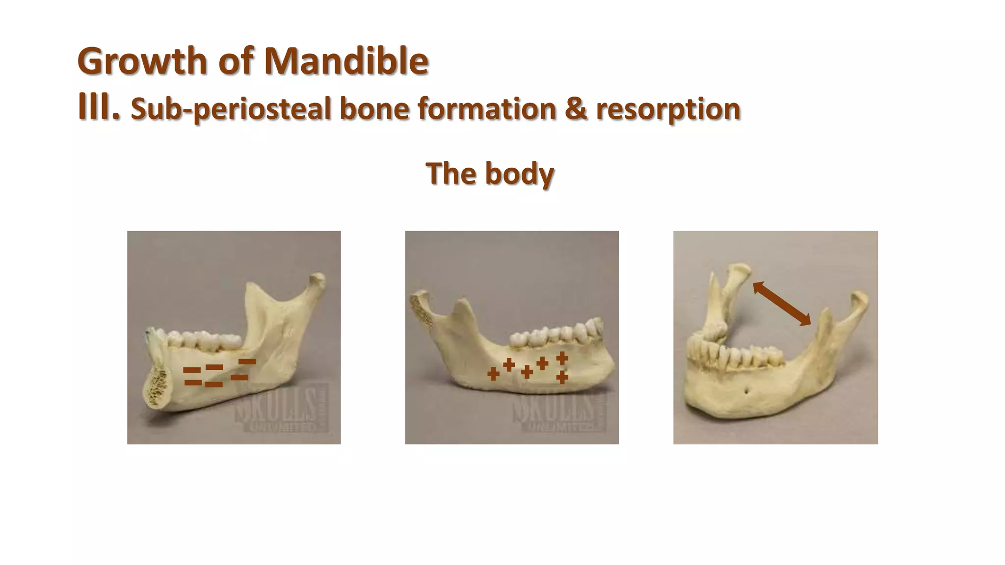 Growth of Mandible
III. Sub-periosteal bone formation & resorption
The body
 