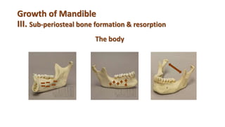 Growth of Mandible
III. Sub-periosteal bone formation & resorption
The body
 