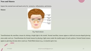 Nose and Sinuses
Inspect the external nose and nasal cavity for symmetry, inflammation, and lesions.
Sinuses
Fig. Nasal sinuses
Transilluminate the maxillary sinuses by shining a bright light in the mouth. Normal maxillary sinuses appear as dull-red crescent-shaped glowing
areas under each eye. Transilluminate the frontal sinuses by placing a light source under the medial aspect of each eyebrow. Normal frontal sinuses
appear as glowing red areas above each eye. Fluid-filled sinuses (e.g., in sinusitis) glow less.
11/7/2023 ashokmourya393@gmail.com 23
 