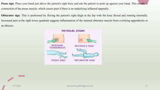 Psoas sign: Place your hand just above the patient's right knee and ask the patient to push up against your hand. This results in
contraction of the psoas muscle, which causes pain if there is an underlying inflamed appendix.
Obturator sign: This is performed by flexing the patient's right thigh at the hip with the knee flexed and rotating internally.
Increased pain at the right lower quadrant suggests inflammation of the internal obturator muscle from overlying appendicitis or
an abscess.
11/7/2023 ashokmourya393@gmail.com 41
 