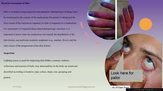 Physical Assessment of Skin
Skin is evaluated using inspection and palpation. Dermatologic findings must
be interpreted in the context of the medications the patient is taking and the
time course of the reaction or response (or lack of response) to a medication.
For assessment of suspected drug-related dermatologic reactions, it is
important to know when the medication was started, the distribution of the
skin lesions, any prelesion systemic symptoms (e.g., malaise, fever), and the
time course of the progression of the skin lesions.
Inspection
Lighting source is used for inspecting skin (Pallor, cyanosis, redness,
yellowness and trauma) of body. Any abnormalities in the body are noted and
described according to location, type, colour, shape, size, grouping and
pattern
11/7/2023 ashokmourya393@gmail.com 7
This Photo by Unknown Author is licensed under CC BY-SA-NC
 