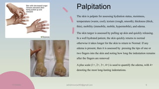 Palpitation
The skin is palpate for assessing hydration status, moistness,
temperature (warm, cool), texture (rough, smooth), thickness (thick,
thin), mobility (immobile, mobile, hypermobile), and edema.
The skin turgor is assessed by pulling up skin and quickly releasing.
In a well hydrated patient, the skin quickly returns to normal
otherwise it takes longer for the skin to return to Normal. If any
edema is present, then it is assessed by pressing the tips of one or
two fingers into the skin and noting how long the indentation remains
after the fingers are removed
A plus scale (1+, 2+, 3+, 4+) is used to quantify the edema, with 4+
denoting the most long-lasting indentations.
11/7/2023 ashokmourya393@gmail.com 8
 