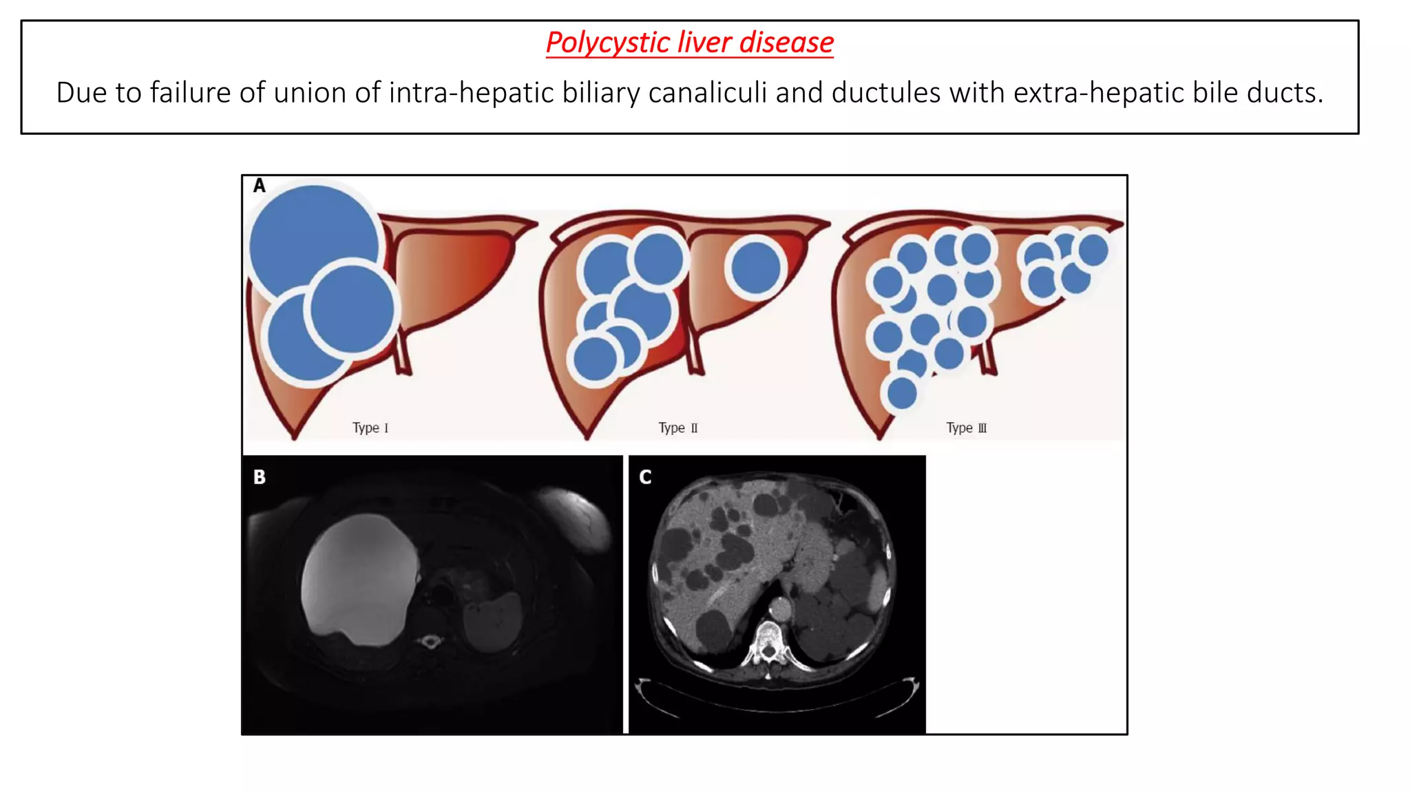 Development of liver, pancreas, spleen and extrahepatic biliary ...