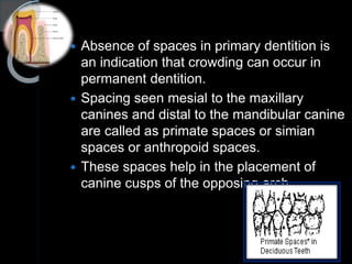 Development of Dentition AND Anomalies | PPTX