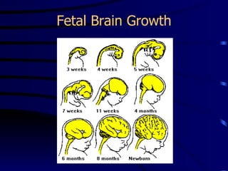 Fetal Brain Growth 