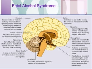 Fetal Alcohol Syndrome  
