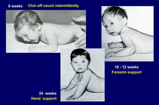 6 weeks Chin off couch intermittently
10 - 12 weeks
Forearm support
24 weeks
Hand support
 