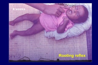4 weeks
Rooting reflex
 