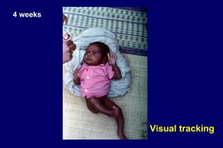 4 weeks
Visual tracking
 