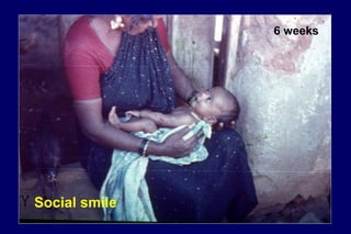 6 weeks
Social smile
 