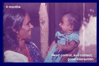 4 months
Head control, eye contact,
good interaction
 