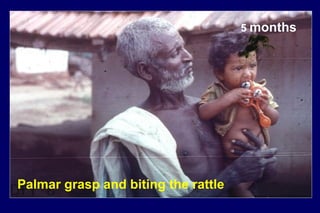 5 months
Palmar grasp and biting the rattle
 