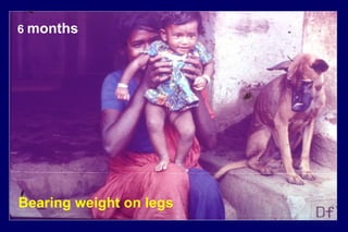 6 months
Bearing weight on legs
 