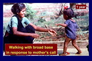 1 year
Walking with broad base
in response to mother’s call
Walking with broad base
in response to mother’s call
 
