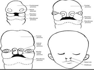 Development of face, palate and jaw | PPTX