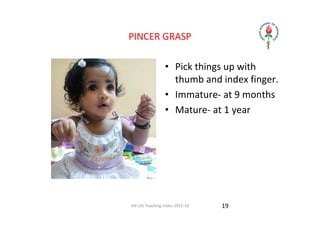 IAP UG Teaching slides 2015‐16
PINCER GRASP 
• Pick things up with 
thumb and index finger.
• Immature‐ at 9 months
• Mature‐ at 1 year
19
 