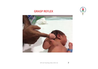 IAP UG Teaching slides 2015‐16
     GRASP REFLEX
7
 