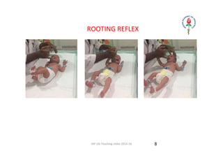 IAP UG Teaching slides 2015‐16
       ROOTING REFLEX
8
 
