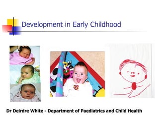 Development in Early Childhood Dr Deirdre White - Department of Paediatrics and Child Health 
