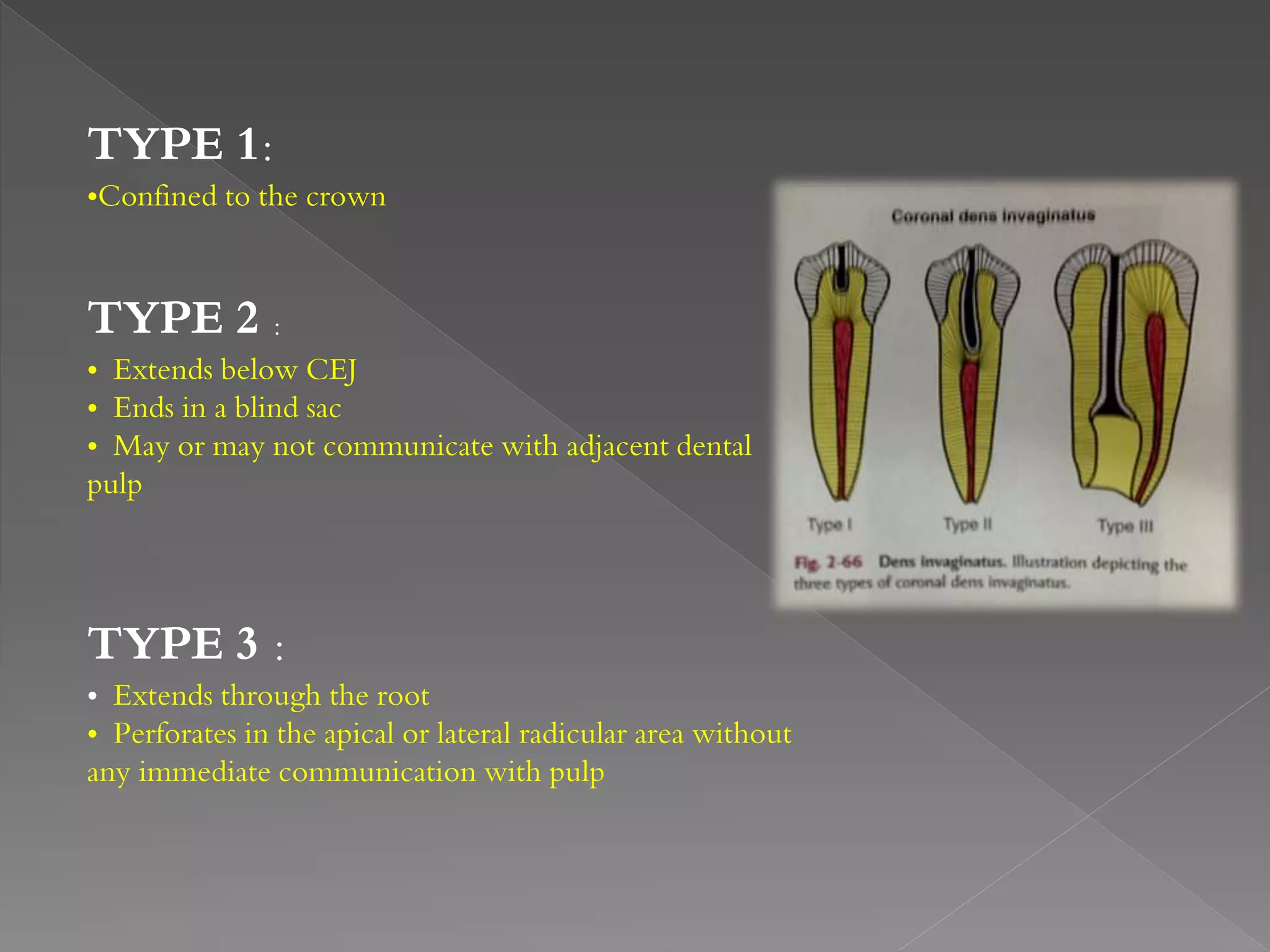Developmental anomalies of teeth - by variyta | PPTX