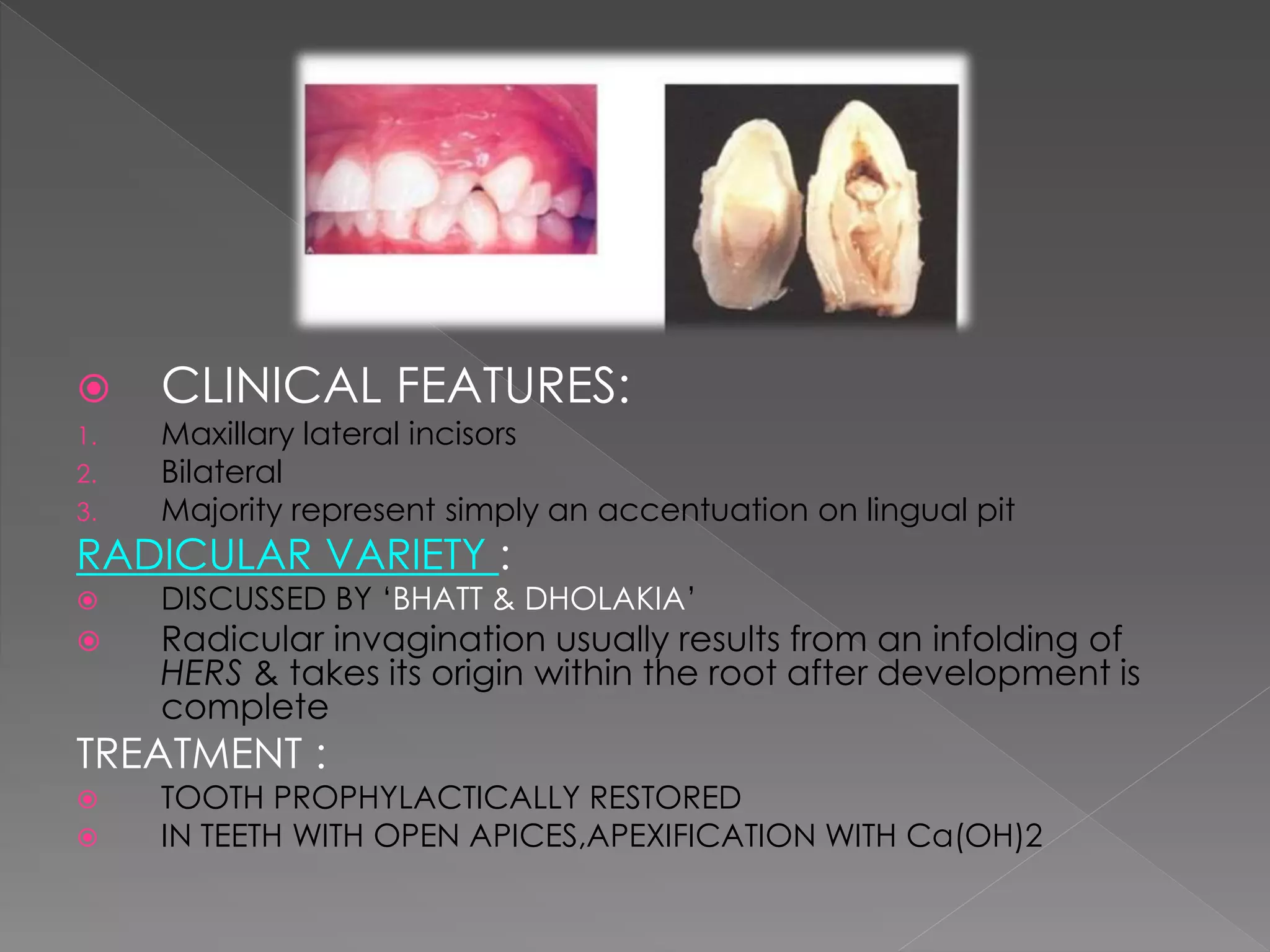 Developmental anomalies of teeth - by variyta | PPTX