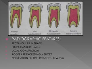 Developmental anomalies of teeth - by variyta | PPTX