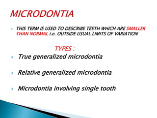 Micro Tooth Developmental anomalies of teeth ,, | PPTX