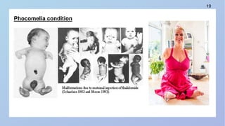 Fucomelia Overview on the modern era of evelopmental biology- pptx | PPTX