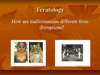 TeratologyTeratology
How are malformations different from
disruptions?
 