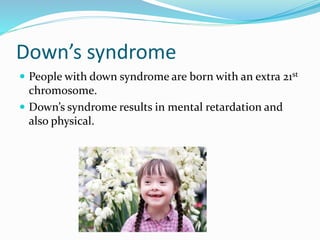 Down’s syndrome
 People with down syndrome are born with an extra 21st
chromosome.
 Down’s syndrome results in mental retardation and
also physical.
 