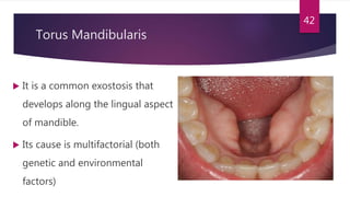 Torus Mandibularis Histology