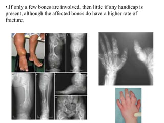 Developmental disorder of musculoskeletal system | PPTX