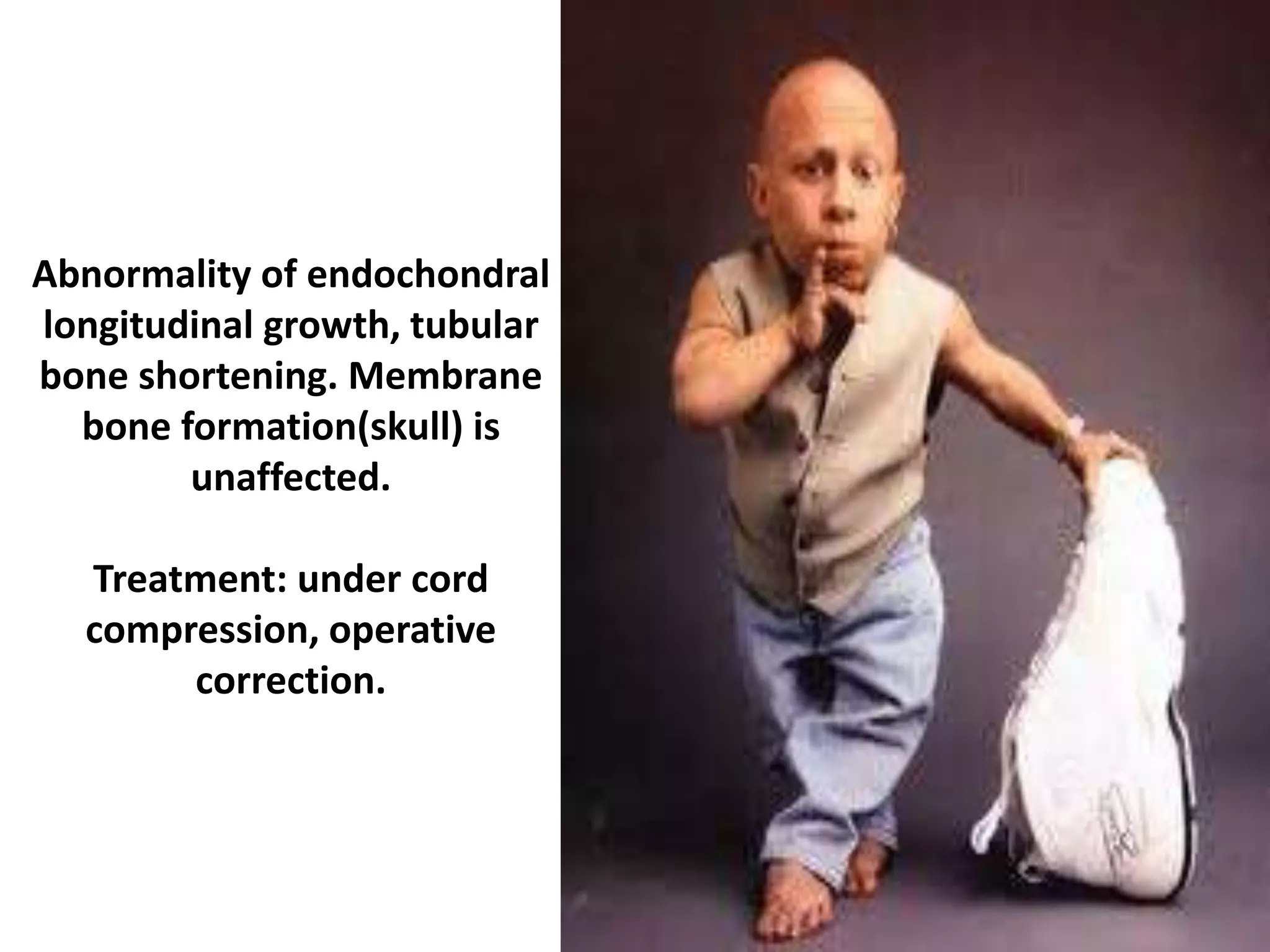 Abnormality of endochondral
longitudinal growth, tubular
bone shortening. Membrane
bone formation(skull) is
unaffected.
Treatment: under cord
compression, operative
correction.
 