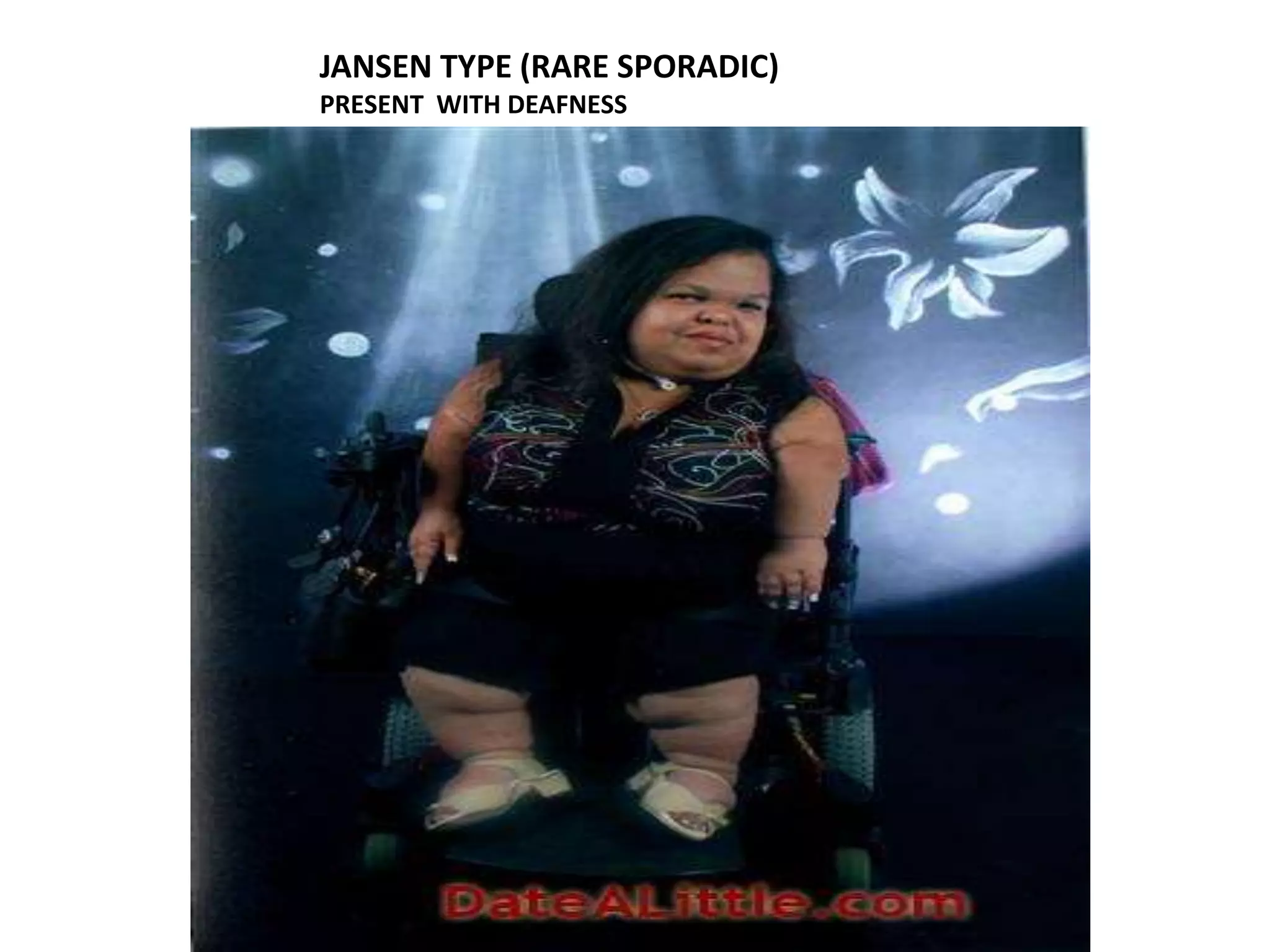 JANSEN TYPE (RARE SPORADIC)
PRESENT WITH DEAFNESS
 