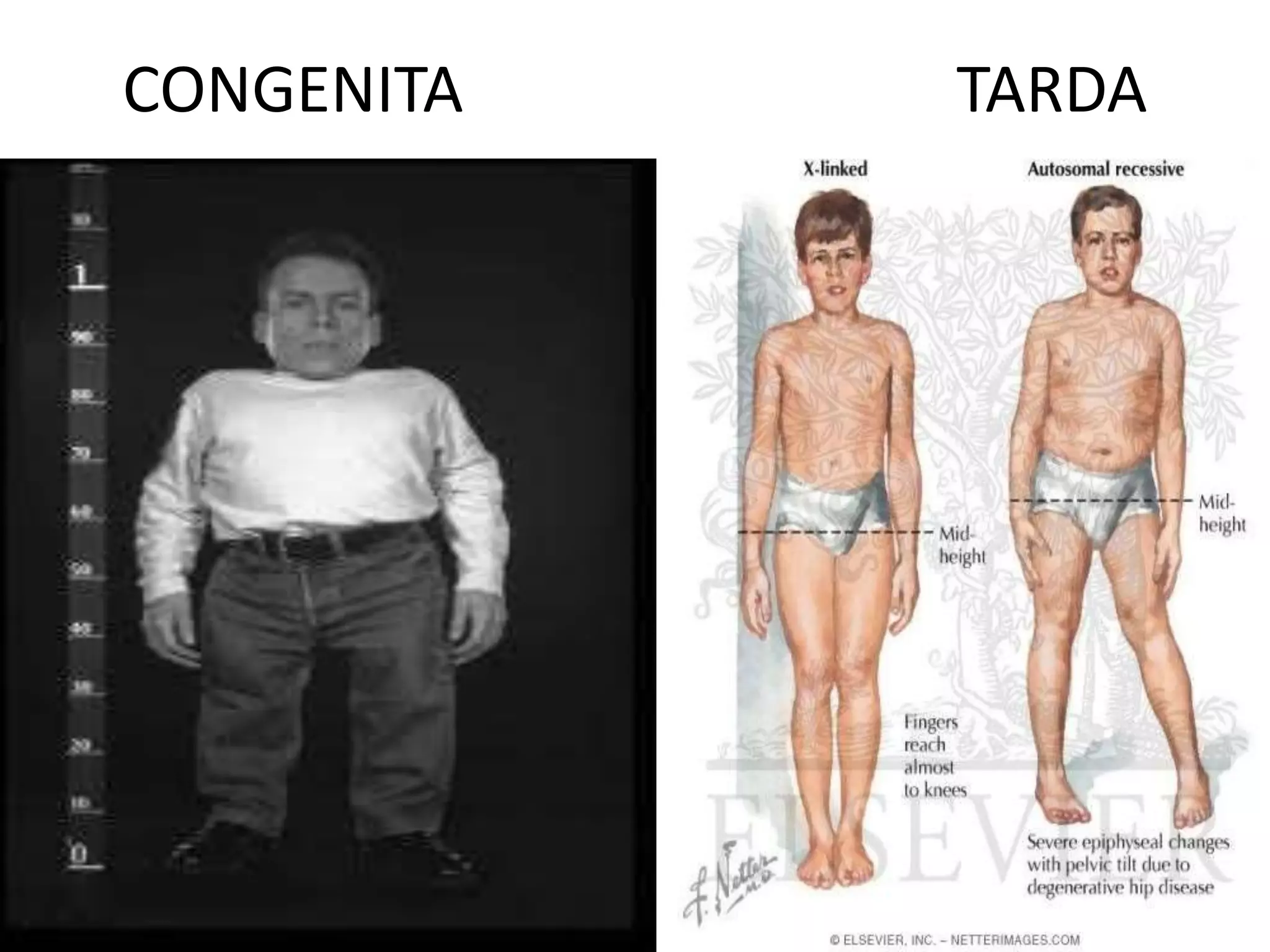 CONGENITA TARDA
 