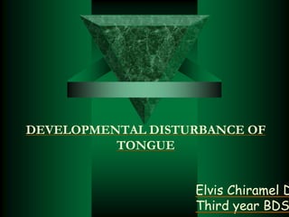 DEVELOPMENTAL DISTURBANCE OF
TONGUE
Elvis Chiramel D
Third year BDS
 