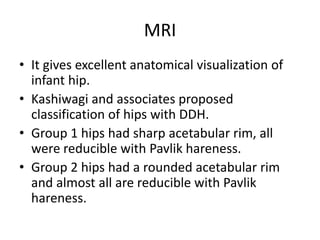 Developmental displasia of hip | PPTX