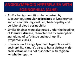 Developmental disturbance of Oral Lymphoid tissue | PPTX