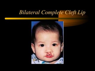 Developmental disorders of orofacial structures dental oral pathology | PPT