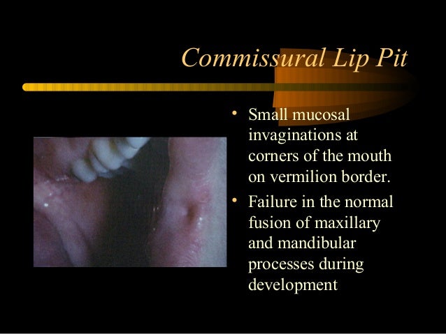 Developmental disorders of orofacial structures dental oral pathology