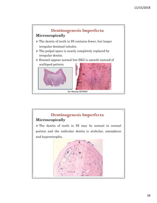 Developmental Disturbances Oral Pathology PDF developmental-disturbances-oral-pathology-pdf