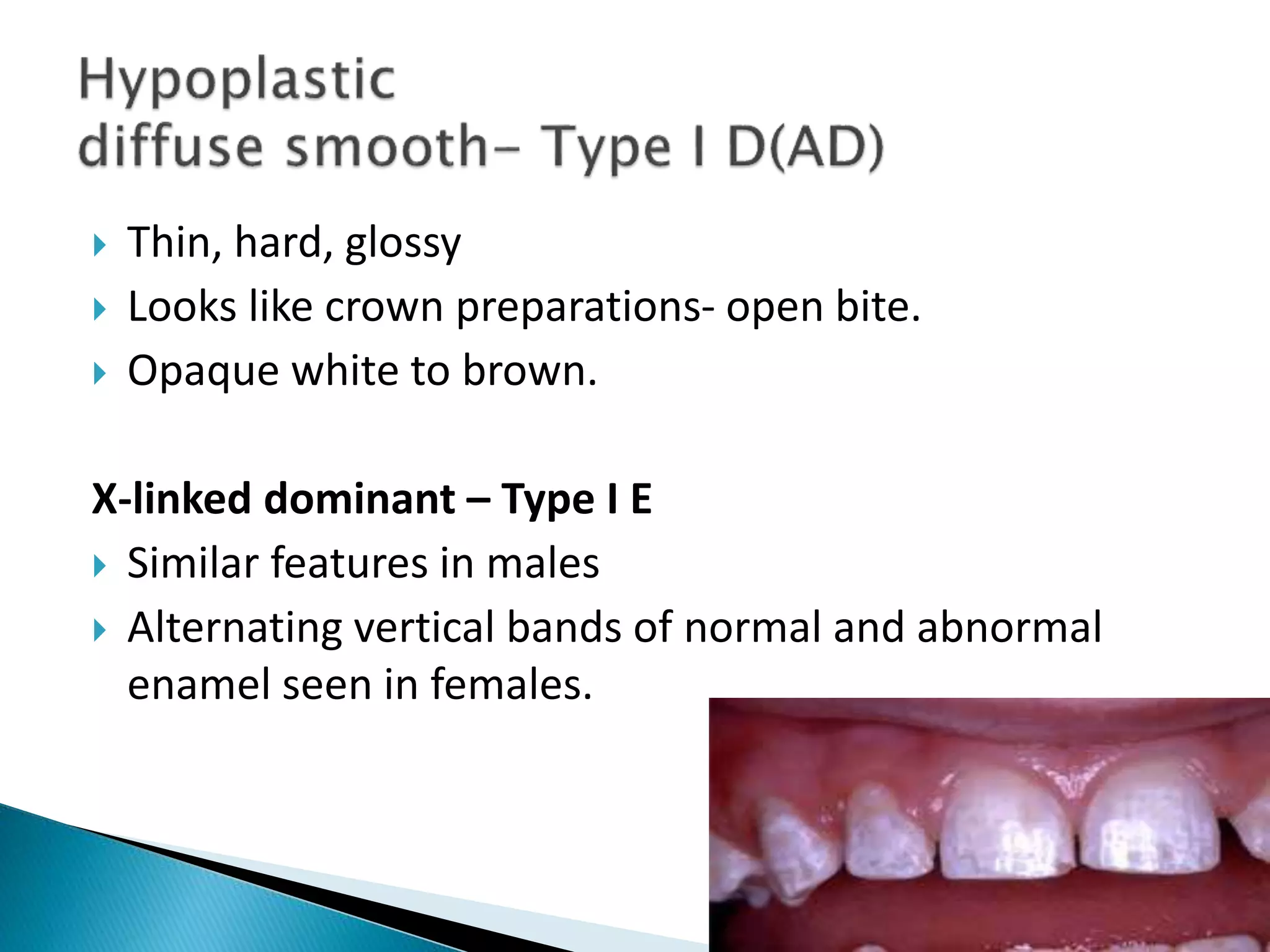  Thin, hard, glossy
 Looks like crown preparations- open bite.
 Opaque white to brown.
X-linked dominant – Type I E
 Similar features in males
 Alternating vertical bands of normal and abnormal
enamel seen in females.
 