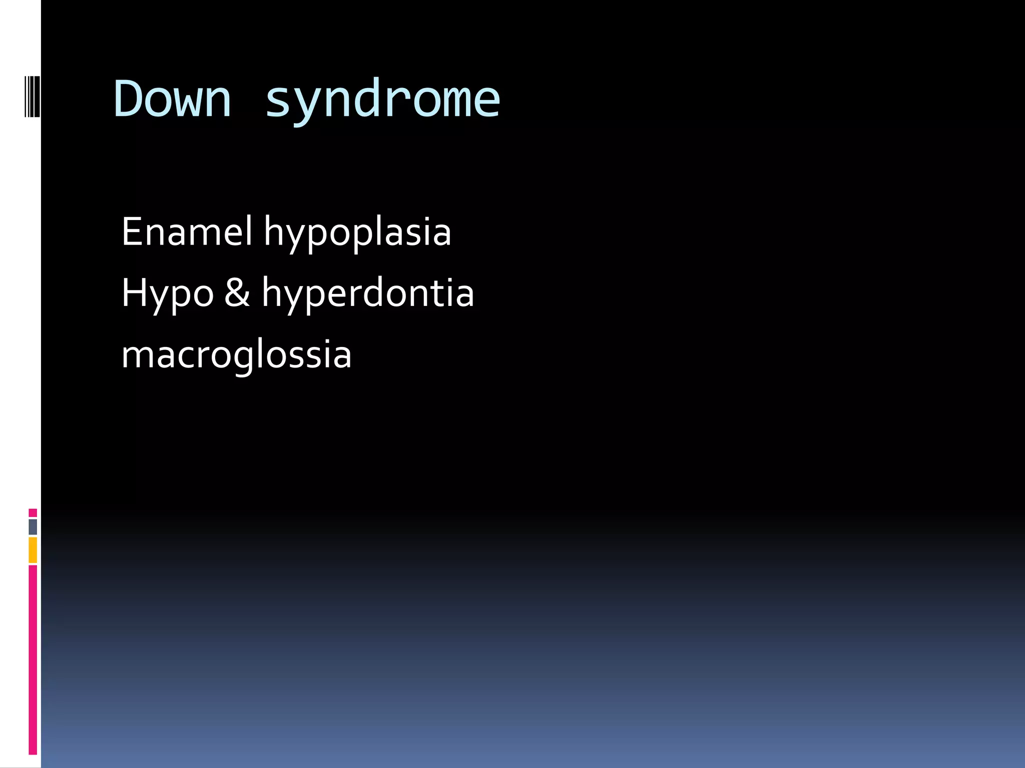 Down syndrome
Enamel hypoplasia
Hypo & hyperdontia
macroglossia
 