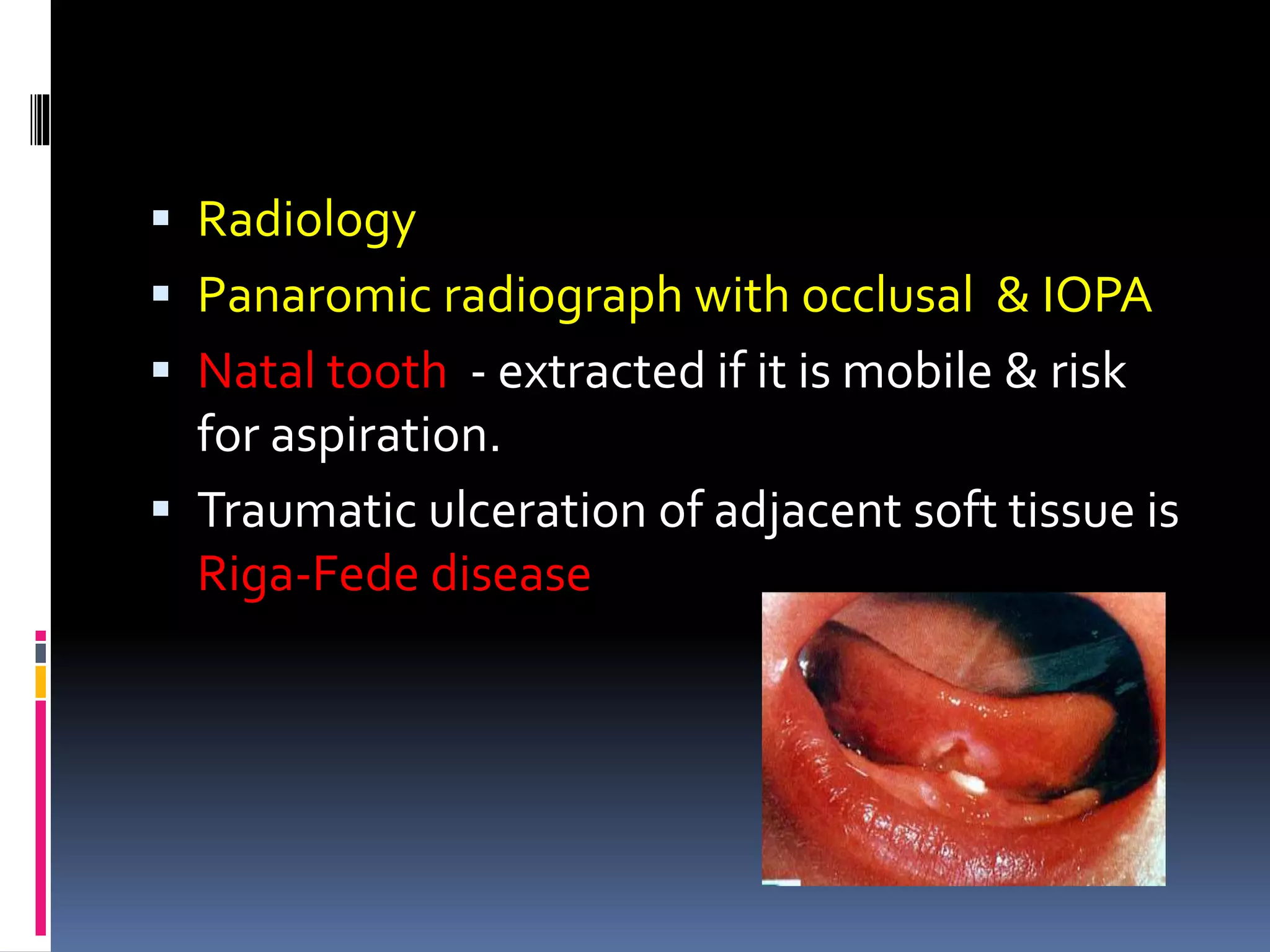  Radiology
 Panaromic radiograph with occlusal & IOPA
 Natal tooth - extracted if it is mobile & risk
for aspiration.
 Traumatic ulceration of adjacent soft tissue is
Riga-Fede disease
 